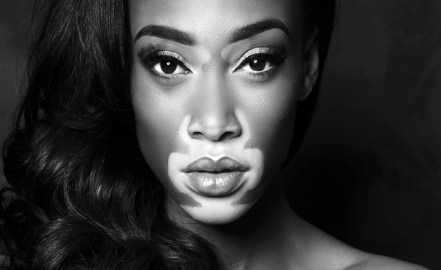 Beauty-Crush-Wednesday-Winnie-Harlow-1