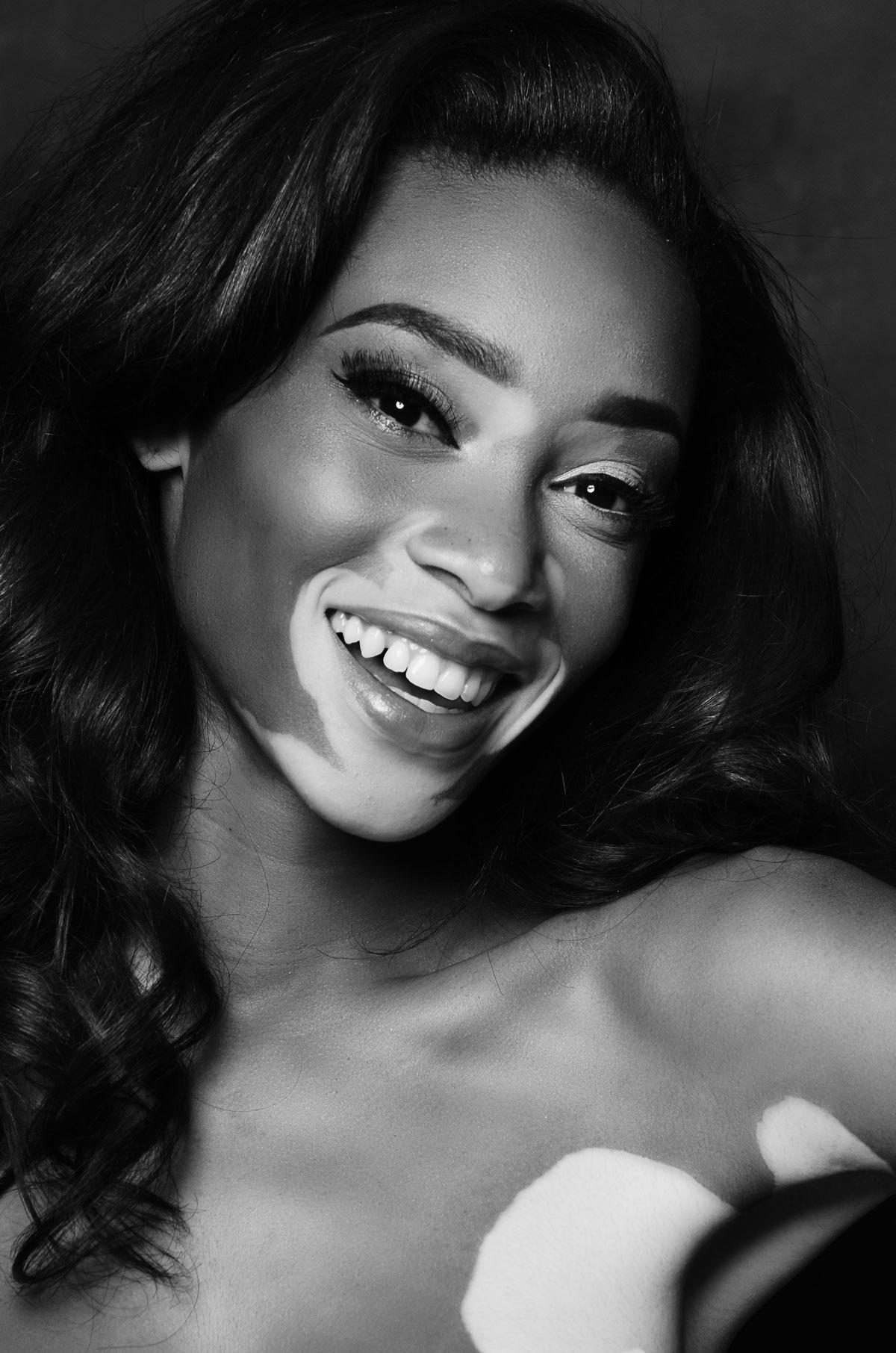Beauty-Crush-Wednesday-Winnie-Harlow-2