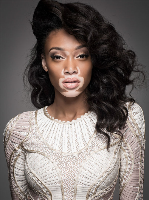 Beauty-Crush-Wednesday-Winnie-Harlow-3