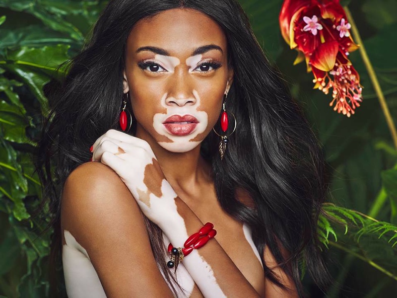 Beauty-Crush-Wednesday-Winnie-Harlow-4