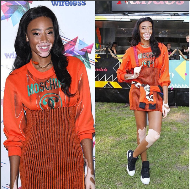 Winnie-Harlow-Moschino-Wirelessfest-1