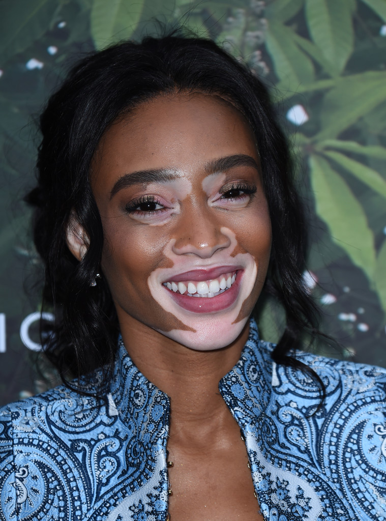 Winnie-Harlow-The-Serpentine-Summer-Party-Balmain-2