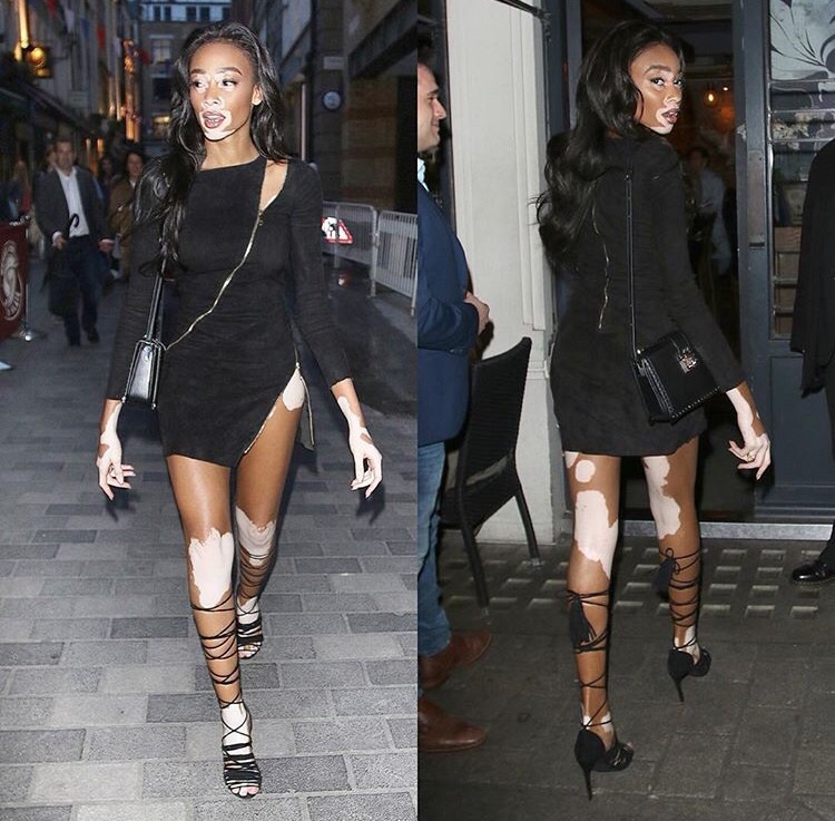 WINNIE-HARLOW-JITROIS-ZIPI-DRESS-2