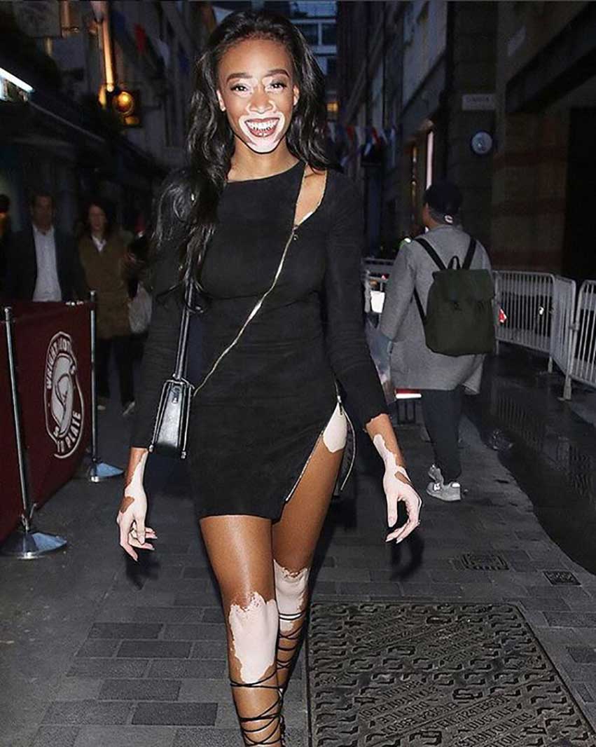 WINNIE-HARLOW-JITROIS-ZIPI-DRESS