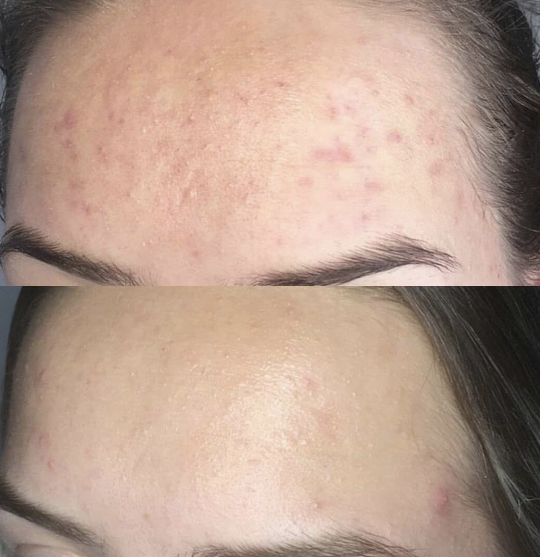 Beauty_Bomb_Product_Of_The_Day_Alya_Skin