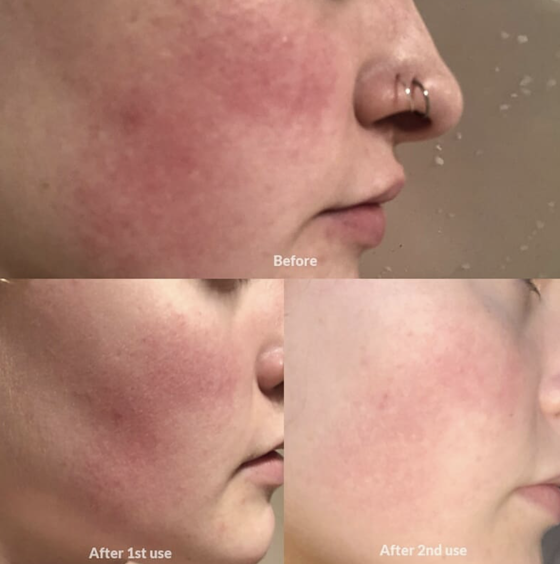 Beauty_Bomb_Product_Of_The_Day_Alya_Skin