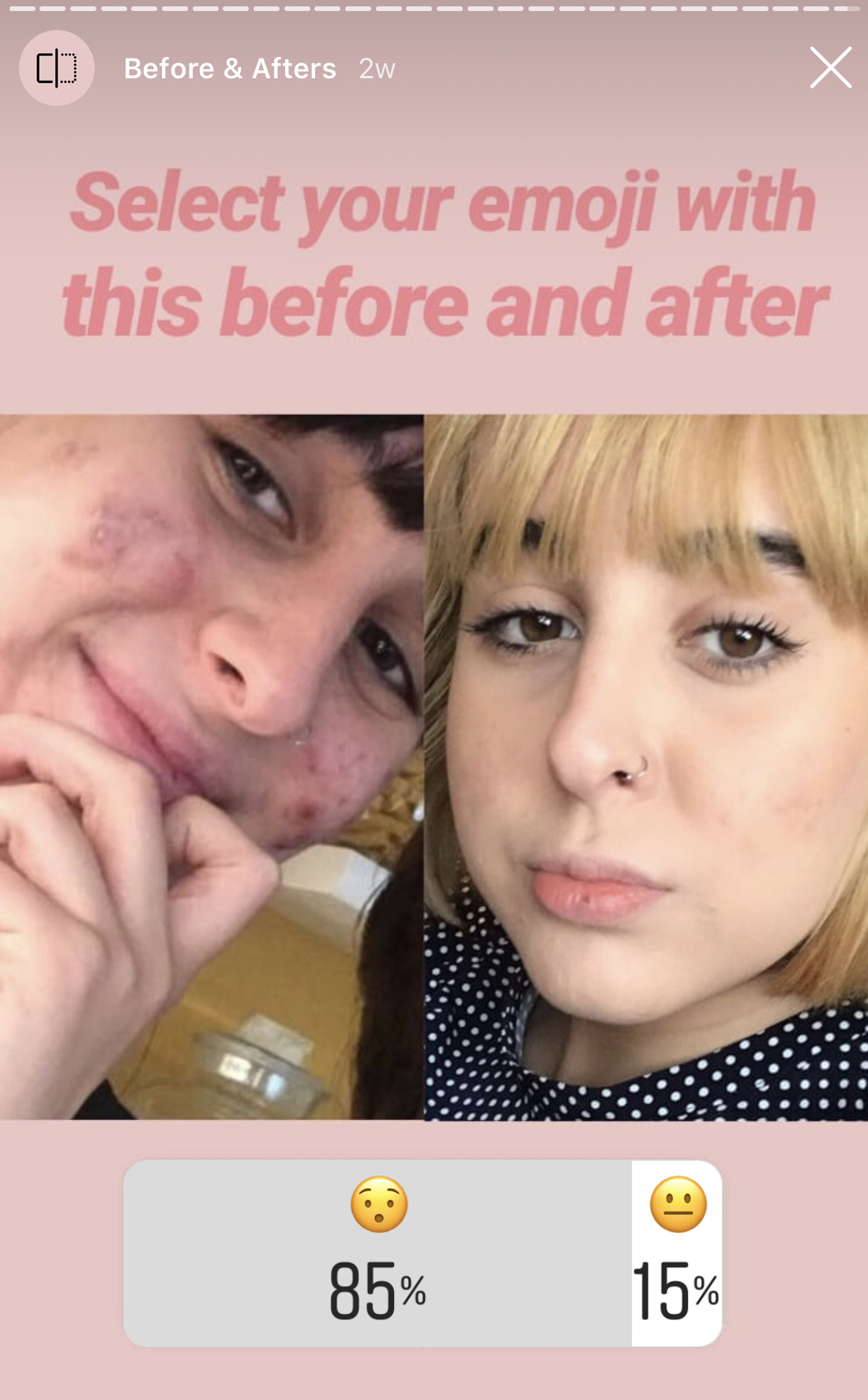 Beauty_Bomb_Product_Of_The_Day_Alya_Skin