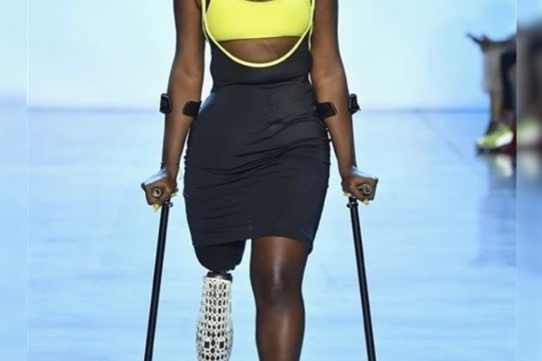 Influential Model, Blogger, and Disability Activist Mama Cax Has Died