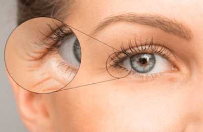 Beauty Tips To Hide Dark Circles and Wrinkles