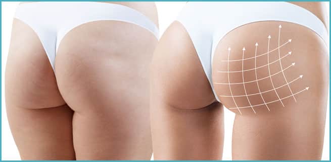 Two Curve Enhancing Treatments Patients Go Crazy About