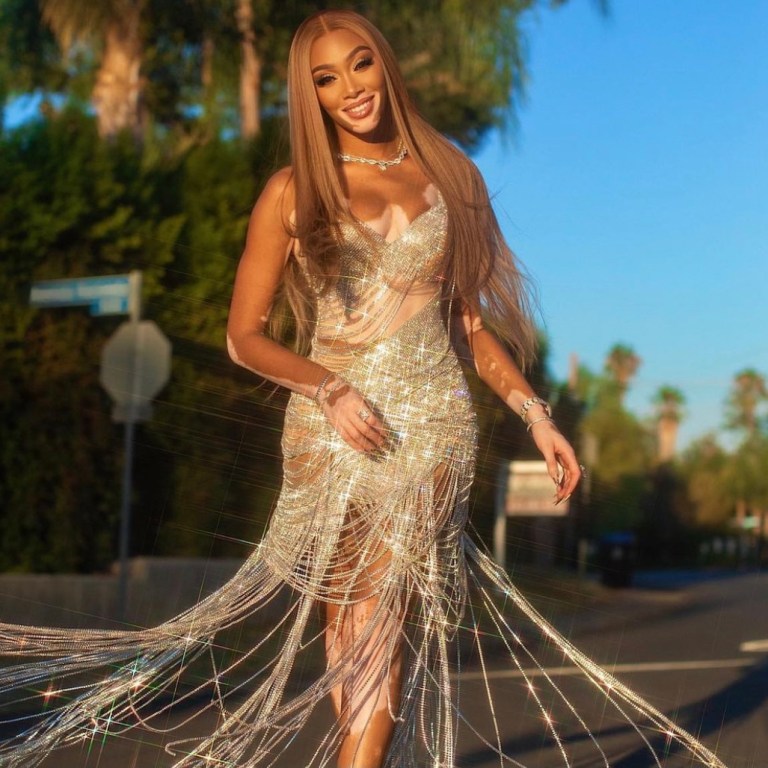 Winnie Harlow Celebrates Her Birthday in Valdrin Sahiti Draped Crystal Fringe Dress