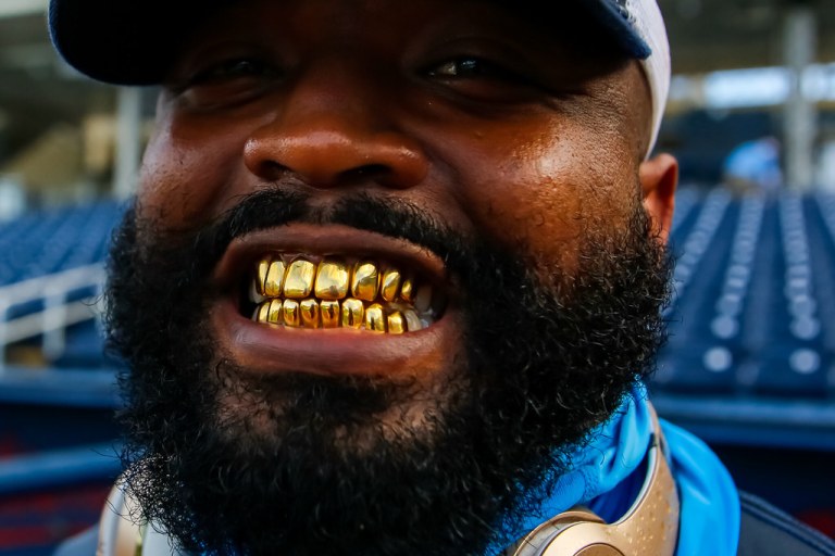 How Gold Teeth Became a Fashion Statement