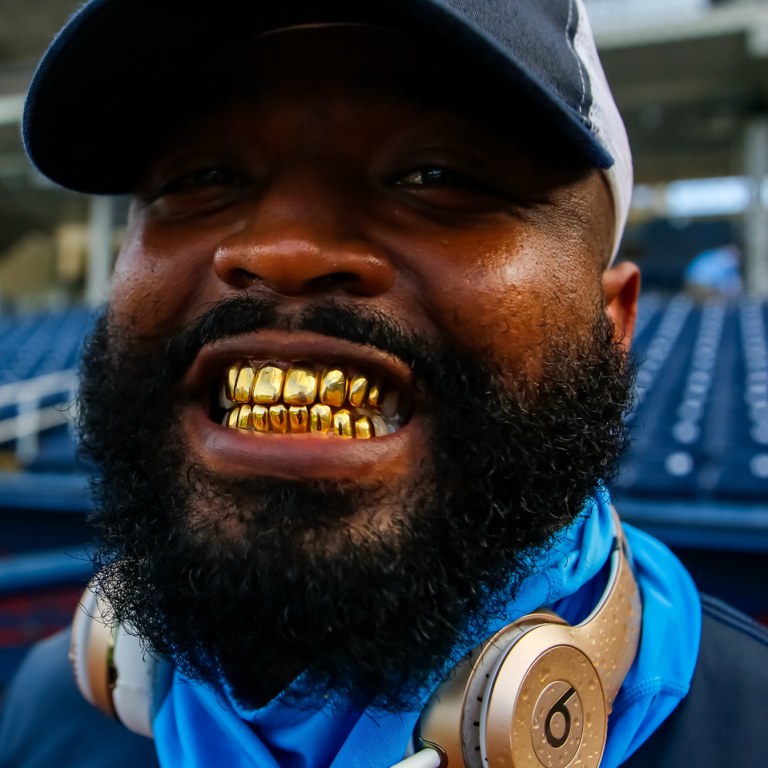 How Gold Teeth Became a Fashion Statement