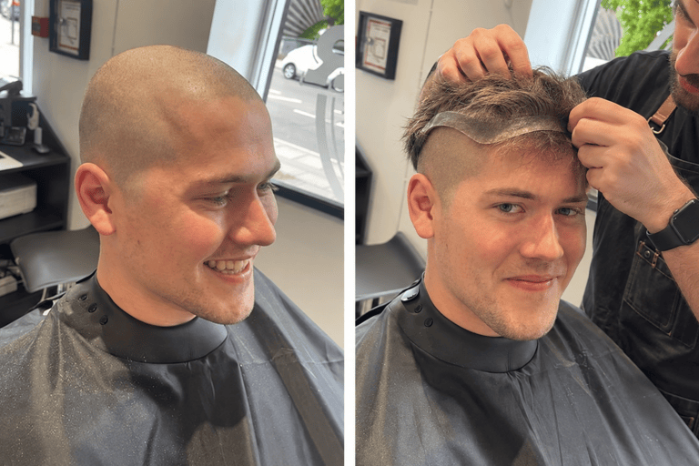 Going Bald? Why Men Choose Hair Systems Over Shaving 
